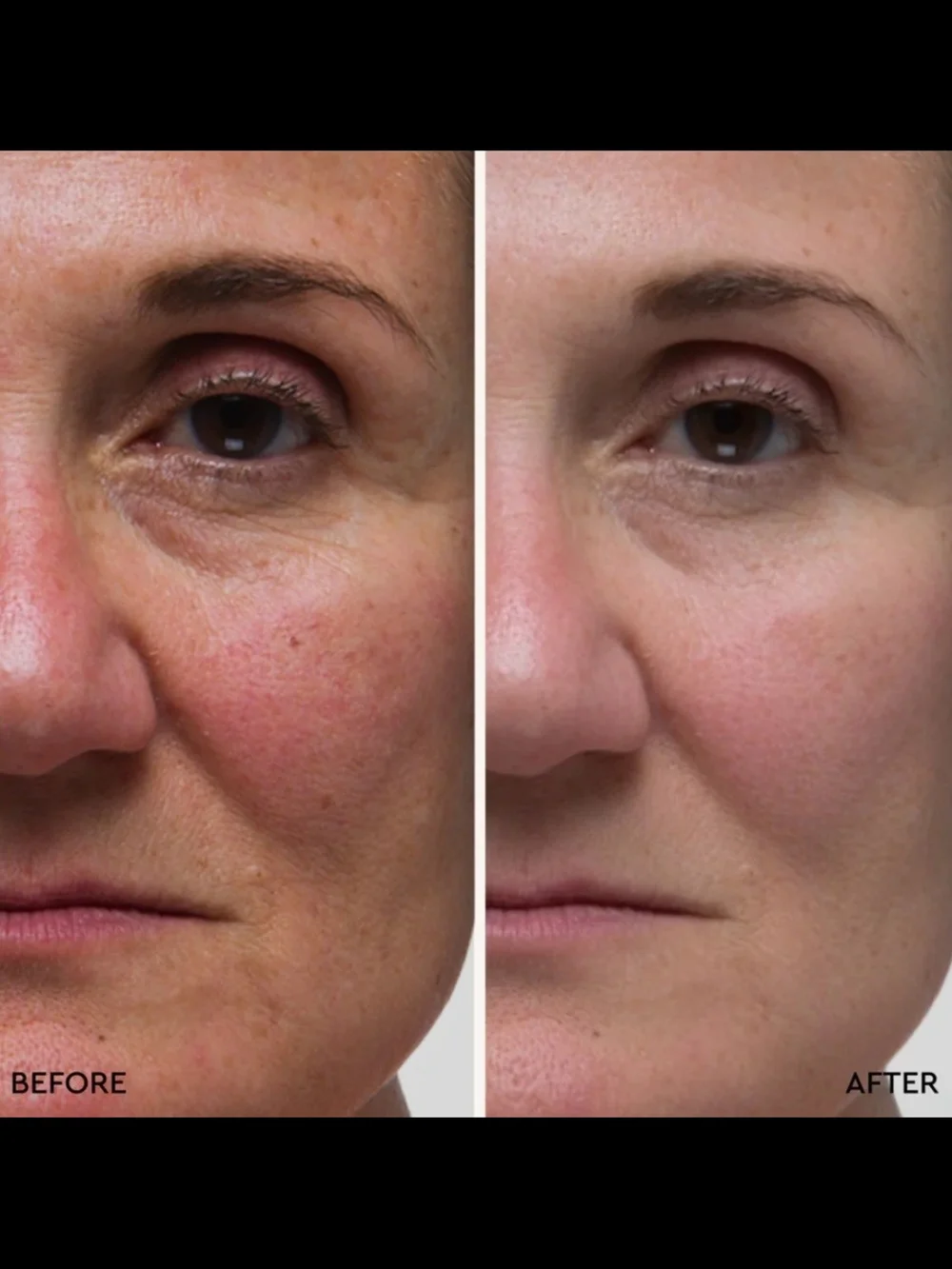 Deep Moisture Mask